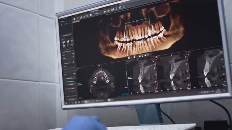 Dental X-Rays and Imaging in Blue Ridge, TX