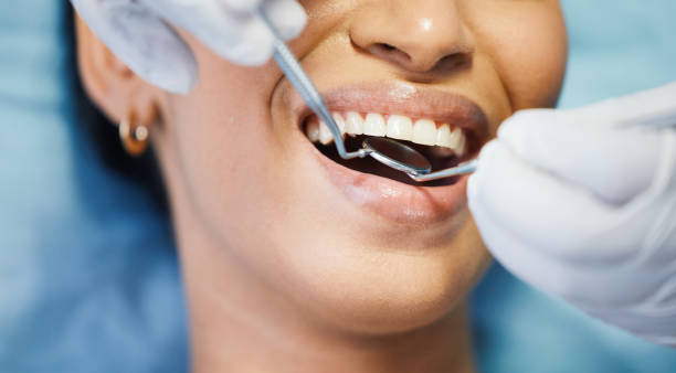 Our Range of Dental Services in Blue Ridge, TX